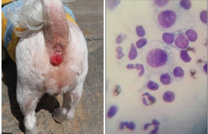 “เนื้องอกสติ๊กเกอร์ แปะปุ๊บ ติดปั๊บ”